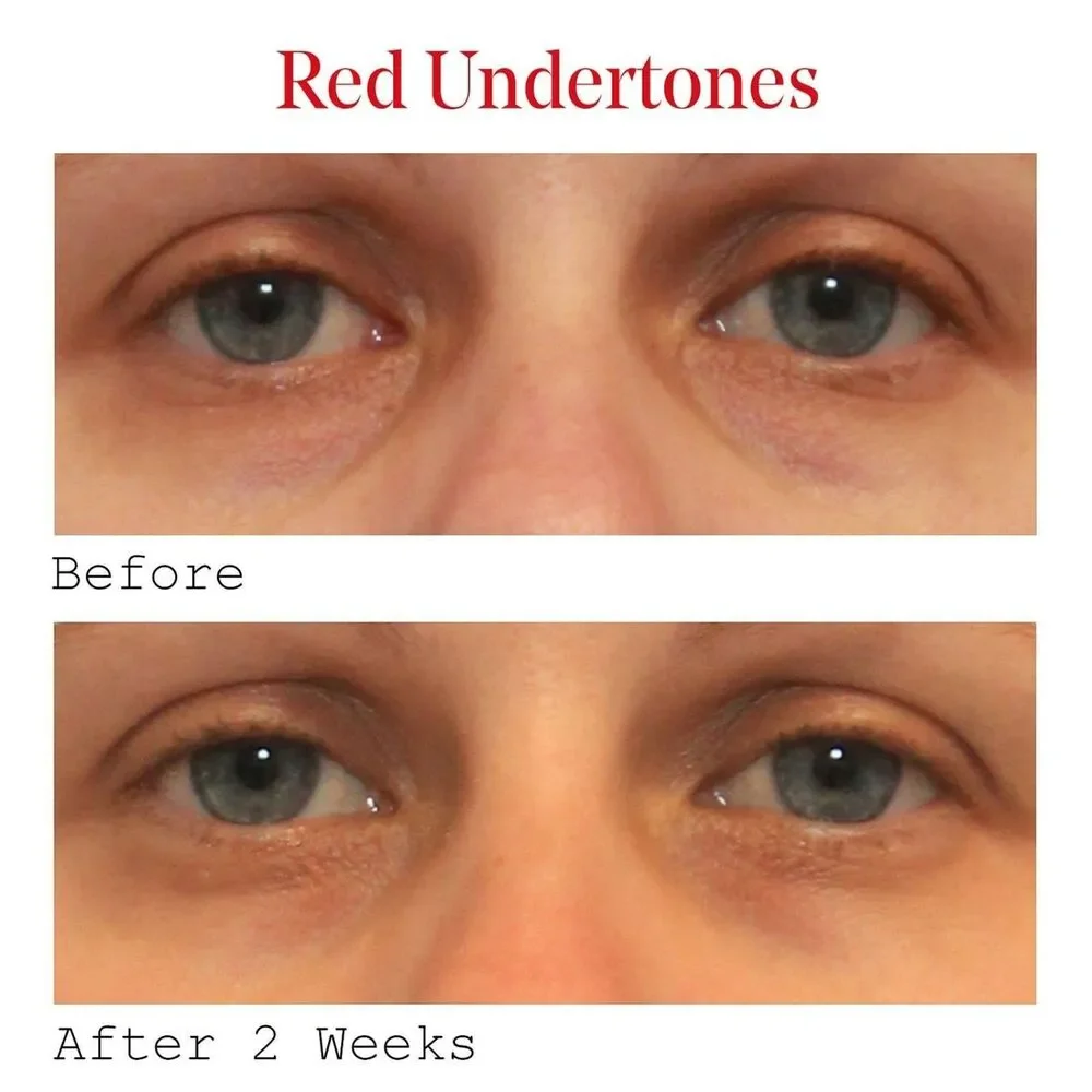 Murad vita eyes
